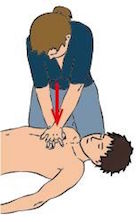 Massage Cardiaque