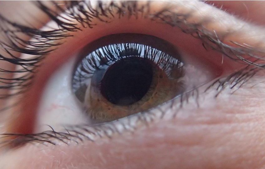 oeil