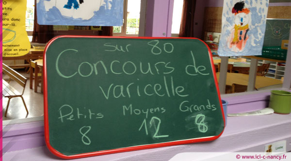 varicelle.concours